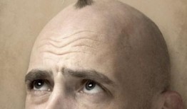 吃瓜秃头男人,揭秘娱乐圈的“秃顶”现象