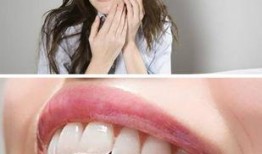 牙疼可以吃白瓜吗