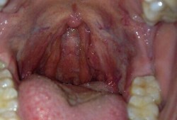 吃瓜之后感觉喉咙,揭秘喉咙不适的奥秘